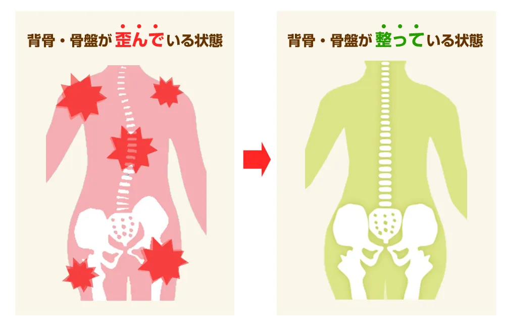 背骨・骨盤が歪んでいる状態と整っている状態のイラスト